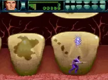 Screenshot of Rex Ronan - Experimental Surgeon (USA) (En,Es)